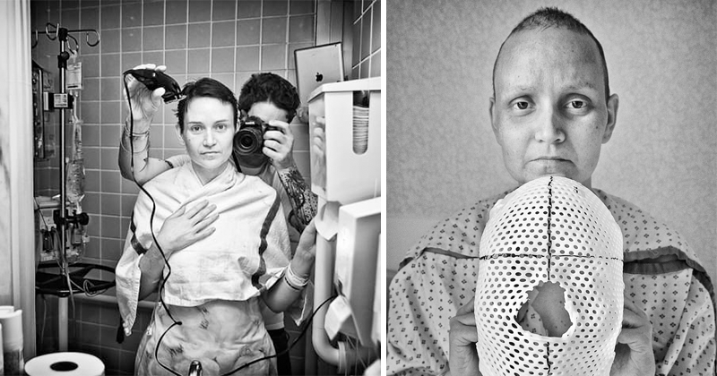 Nuotraukų Serija, Kurioje Užfiksuota Vėžiu Sergančios Moters Kova Su Liga